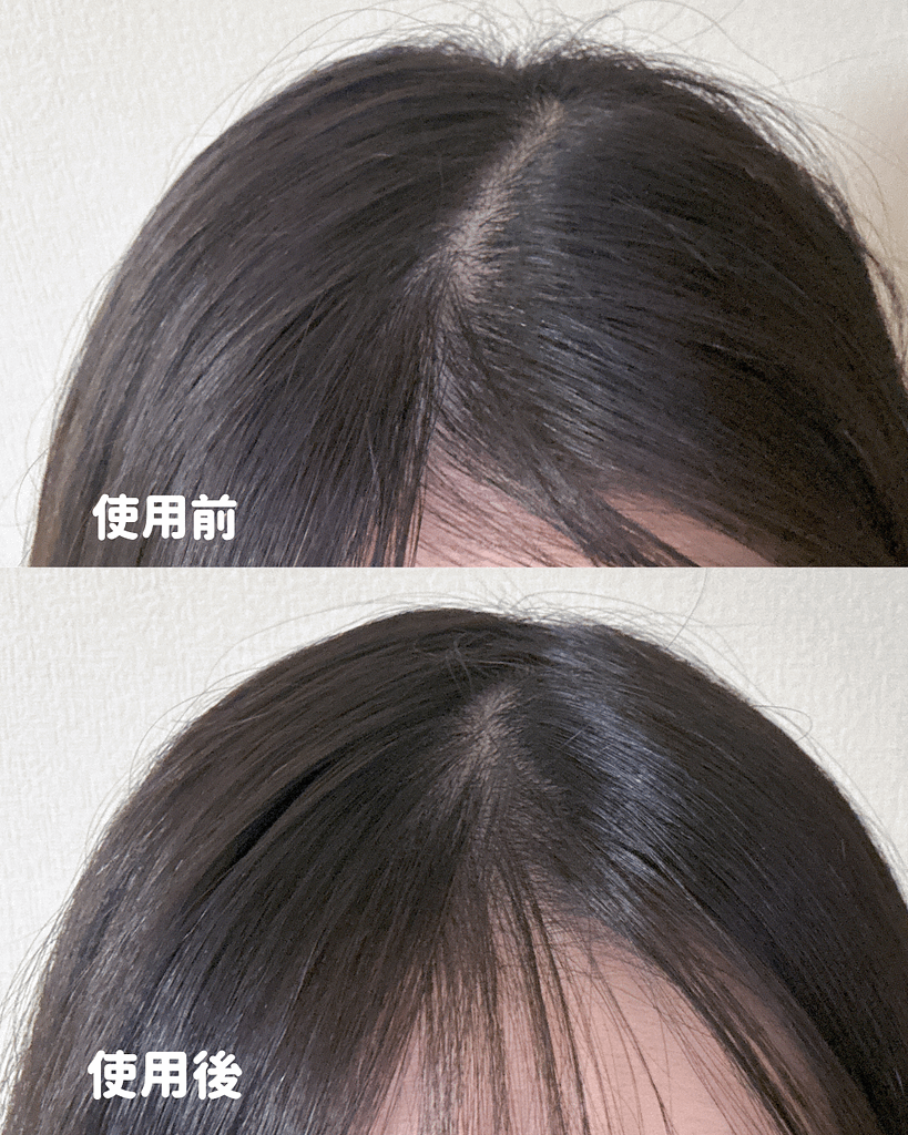 VT 頭皮用美容セラム 使用後